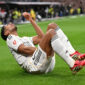 Real Madrid Pincang Jude Bellingham Absen Sebulan Akibat Cedera Hamstring Parah