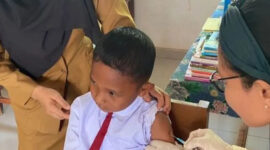 Dinkes Batam Perkuat Pemantauan Campak Meski Lonjakan Kasus Belum Signifikan